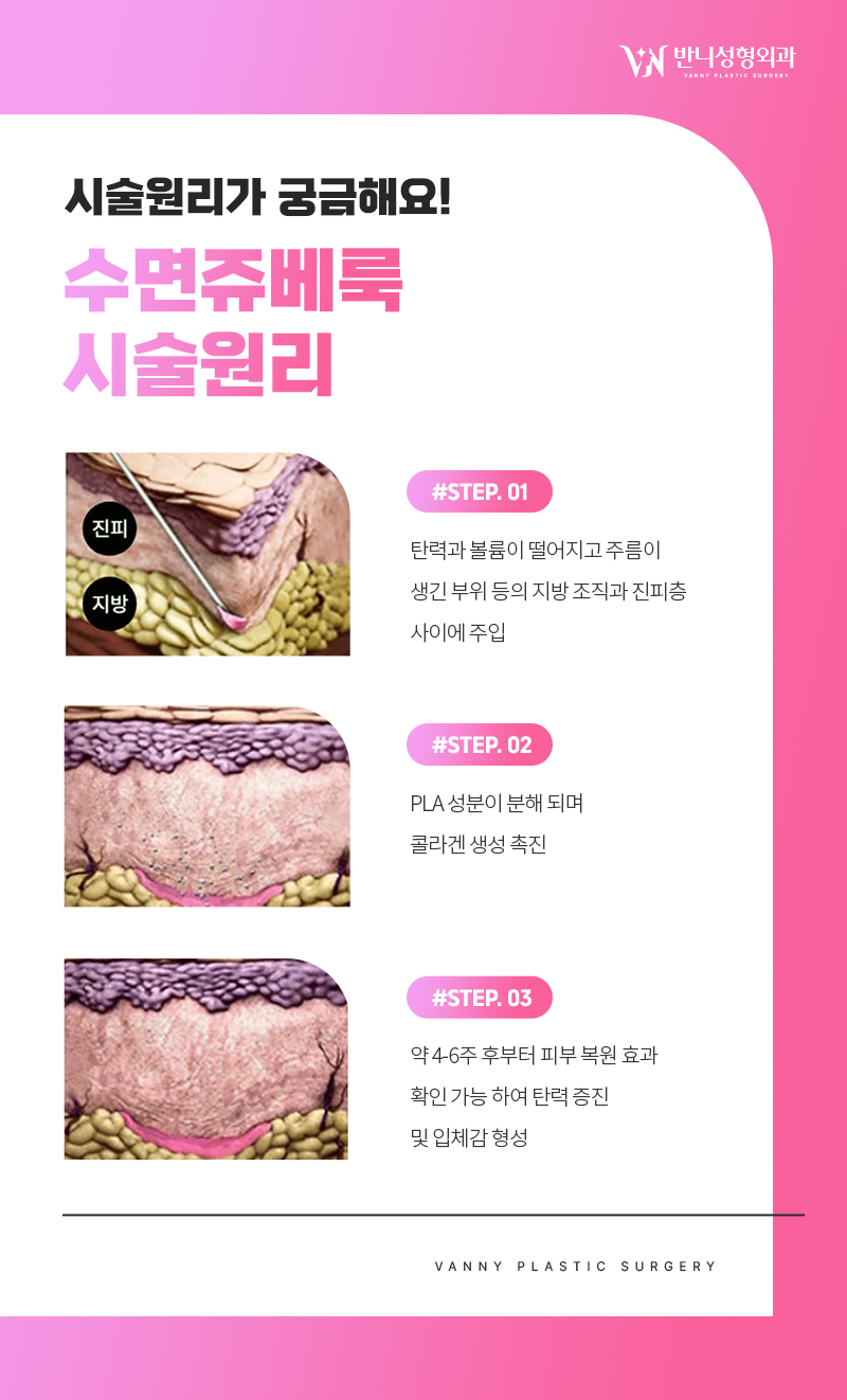 강남역쥬베룩 효과 보기 위해서는 관련 이미지 7