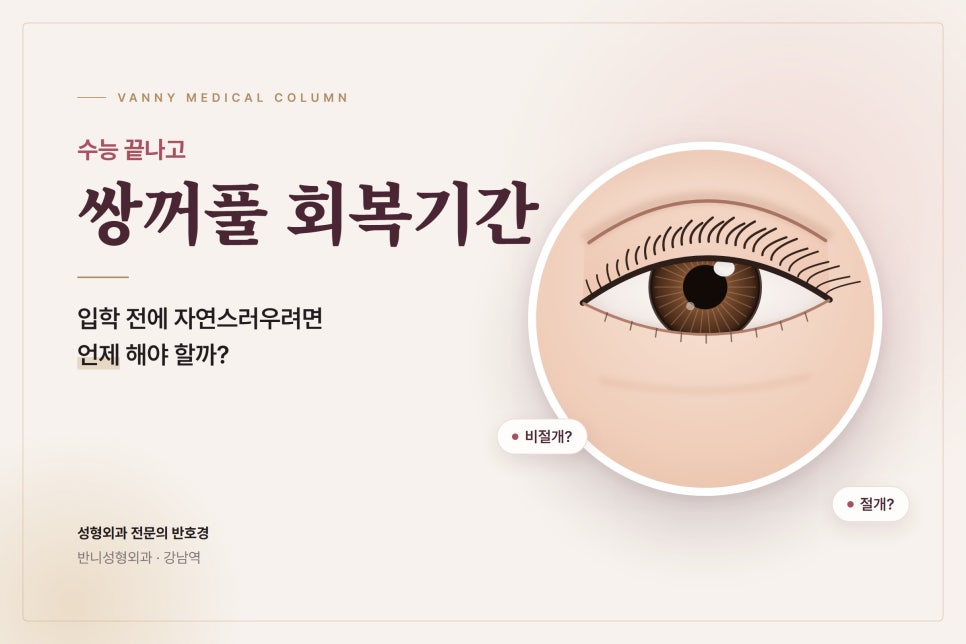 수능 끝나고 쌍꺼풀, 수험생·부모님이 상담실에서 가장 많이 묻는 4가지 관련 이미지 1