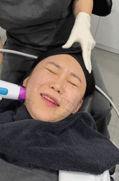 강남 써마지 피부과 마취 옵션 확인은 필수 (+통증 비교) 관련 이미지 12
