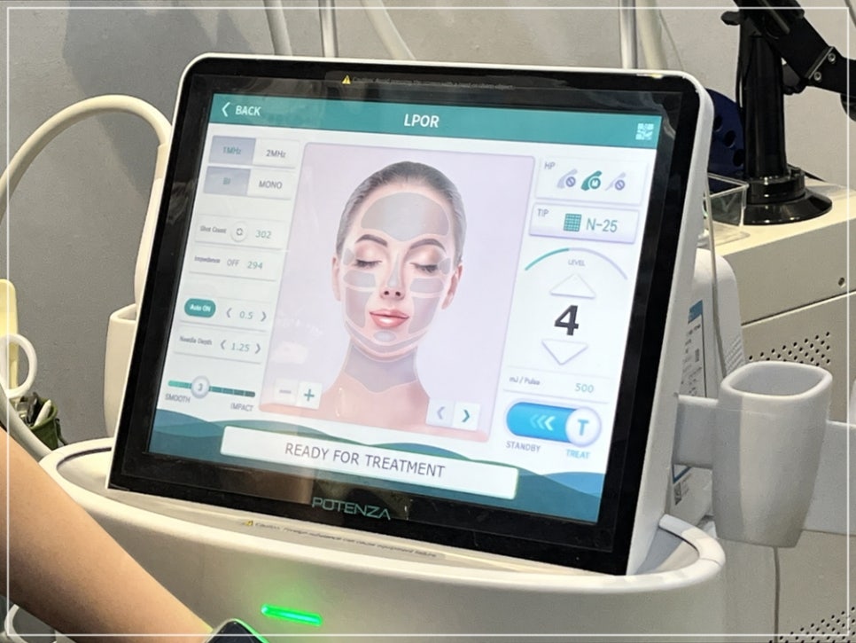 How to Reduce Pores in Gangnam: The Real Effect of Potenza Pumping Tip for Nose Pores, Explained by a Dermatology Clinic Director image 2