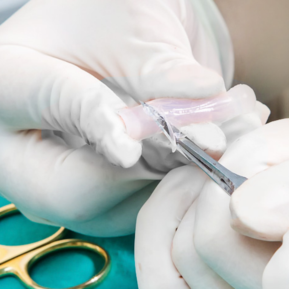 Gangnam Rhinoplasty: The Process of Finding Natural Proportions and Harmony image 6