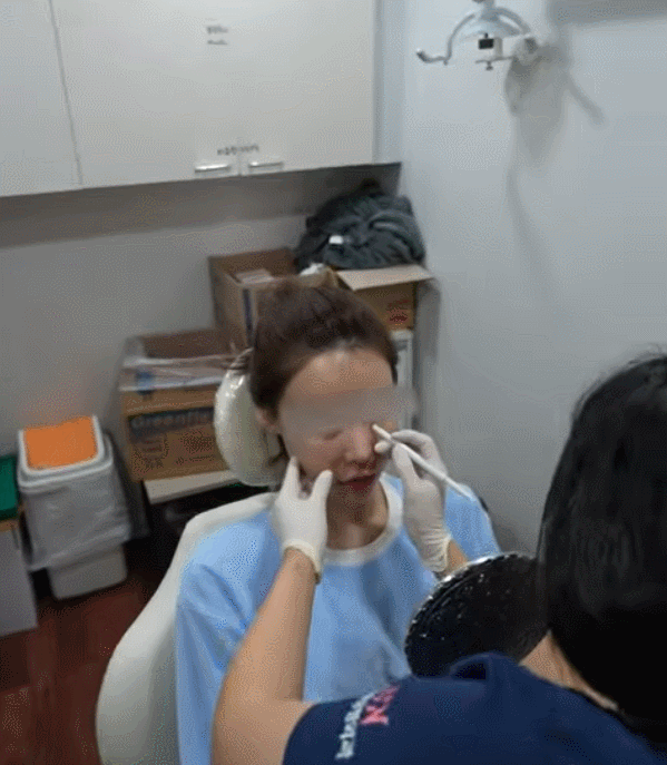 눈밑지방재배치 시술 효과, 통증, 붓기, 후 관리까지 이 글로 종결 관련 이미지 2