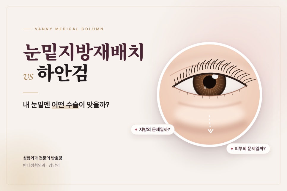 눈밑지방재배치 하안검 차이, 상담실에서 보는 눈밑 유형 3가지 관련 이미지 1