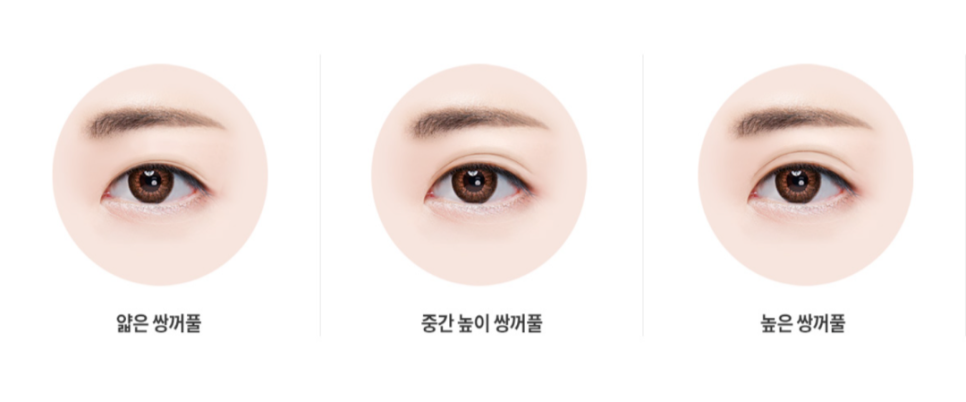 쌍커풀 자연유착 : 반짝유착으로 오래 유지되는 자연스러운 눈매 관련 이미지 2
