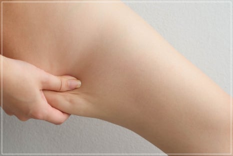 What Is a Dermatology Clinic That Does Great Calf and Trapezius Botox, Hyperhidrosis Botox, and Fat-Dissolving Injections for Body Care in Gangnam? (+Event) image 12