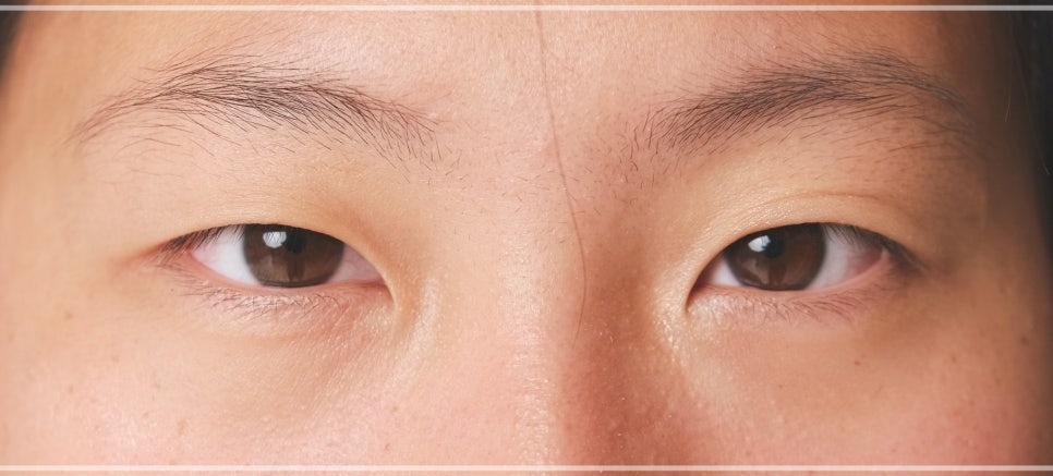 강남역 필러 잘하는 곳, 눈밑 애교 입술 시술 여부먼저 확인하세요 관련 이미지 13