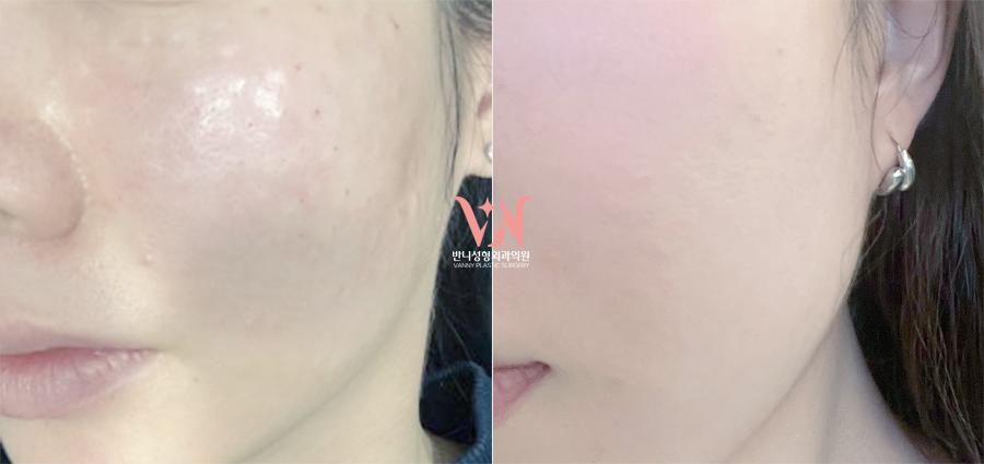 If You’ve Been Visiting a Dermatology Clinic Regularly but See No Change, the Issue May Be the Direction You’re Taking — Recommended Gangnam Dermatology Clinic Specializing in Rituo image 4