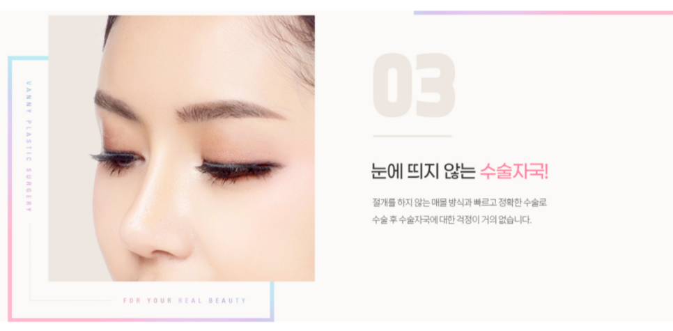 쌍커풀 자연유착 : 반짝유착으로 오래 유지되는 자연스러운 눈매 관련 이미지 5