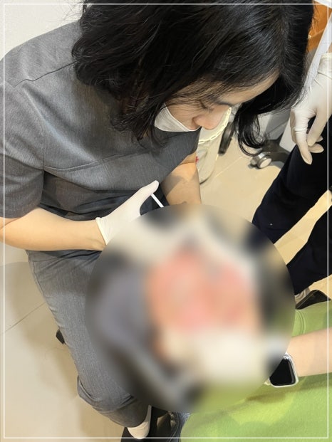 리쥬란힐러 통증 잡는 마취방법 5가지 피부과 원장의 총정리 관련 이미지 8