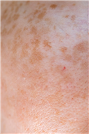 Gangnam Re2O Treatment: Controversy Over Use of Human Tissue and Side Effects? Misconceptions and Facts About Re2O. image 29