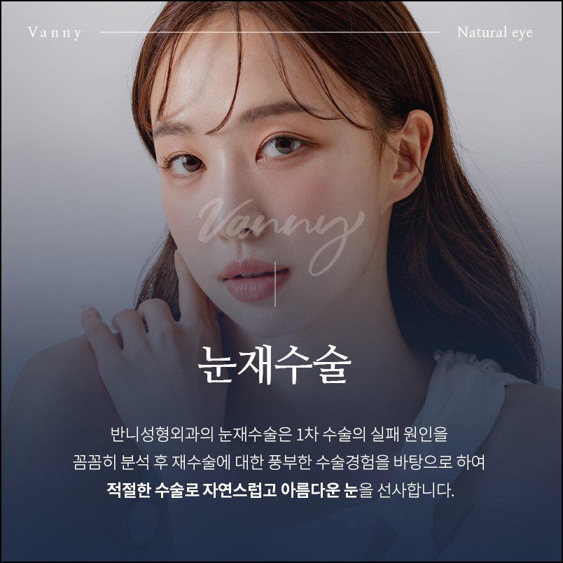 강남눈성형외과 두번의 실패를 하지 않기 위해 관련 이미지 2