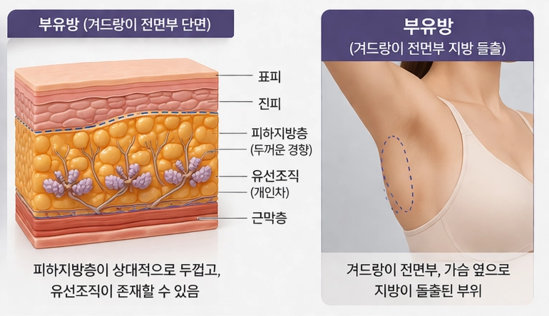 강남 온다 리프팅 망하는 가장 흔한 이유, 온다 리프팅 문의 하루 30건 받는 강남 피부과 원장이 솔직하게 말씀드립니다. 관련 이미지 16