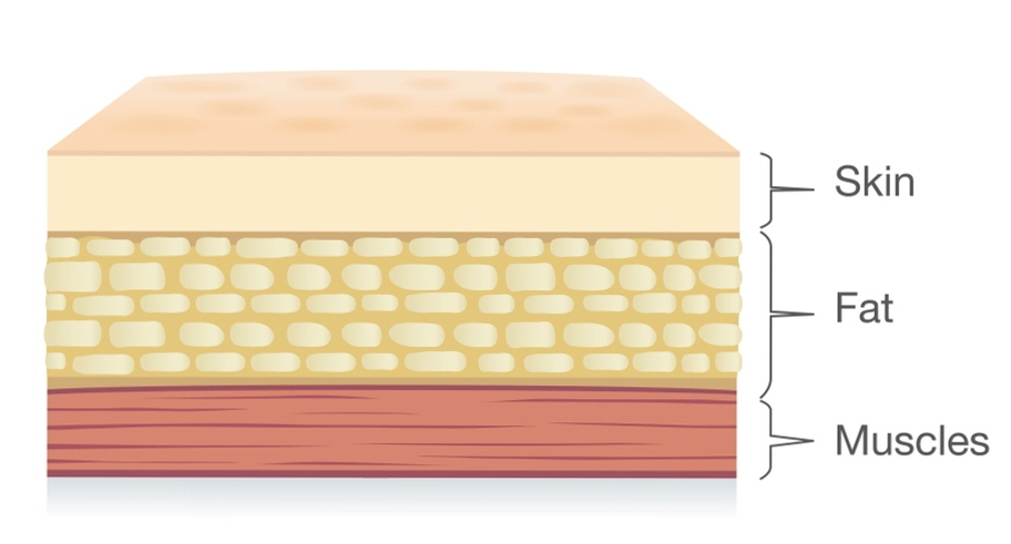 What Is a Dermatology Clinic That Does Great Calf and Trapezius Botox, Hyperhidrosis Botox, and Fat-Dissolving Injections for Body Care in Gangnam? (+Event) image 17
