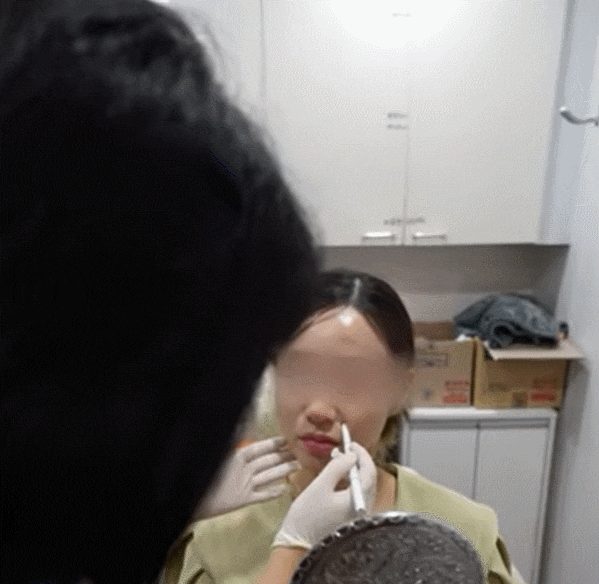 강남실리프팅 실제 디자인 과정 A부터 Z까지, 피부과 원장이 알려드림 관련 이미지 16