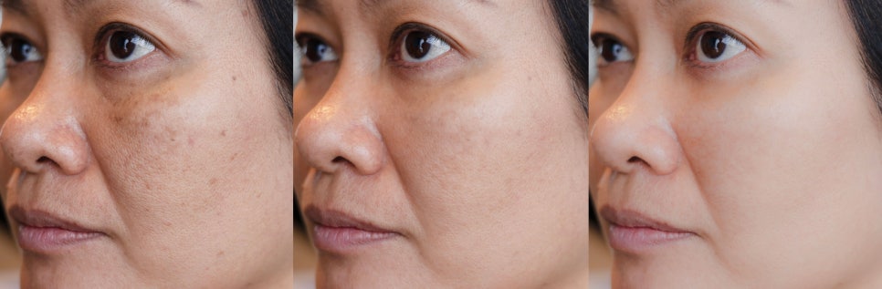 Why is Gangnam Potenza expensive but ineffective? Stop wasting your money. image 3