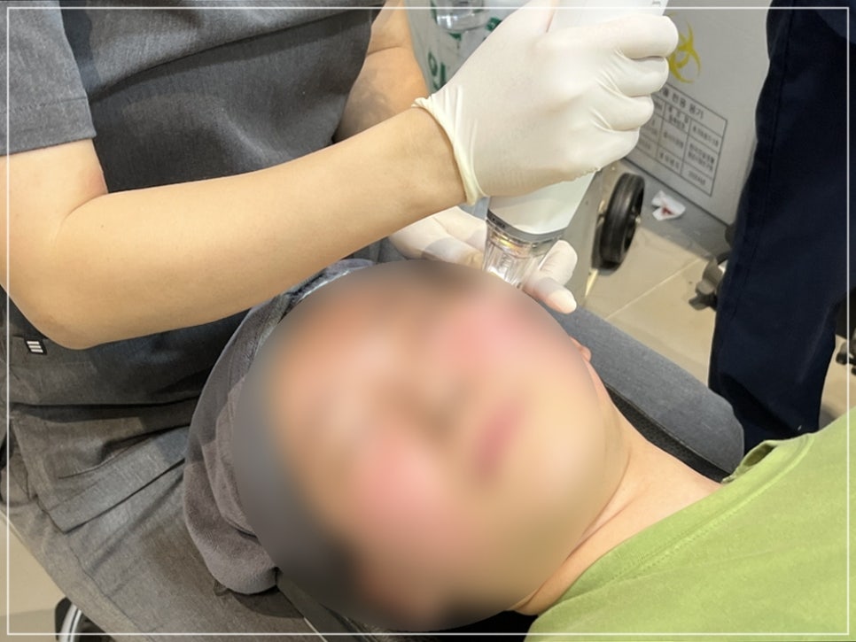 포텐자 여드름, 흉터 자국까지 하나로 올킬 가능한 이유 (+펌핑팁 효과) 관련 이미지 6
