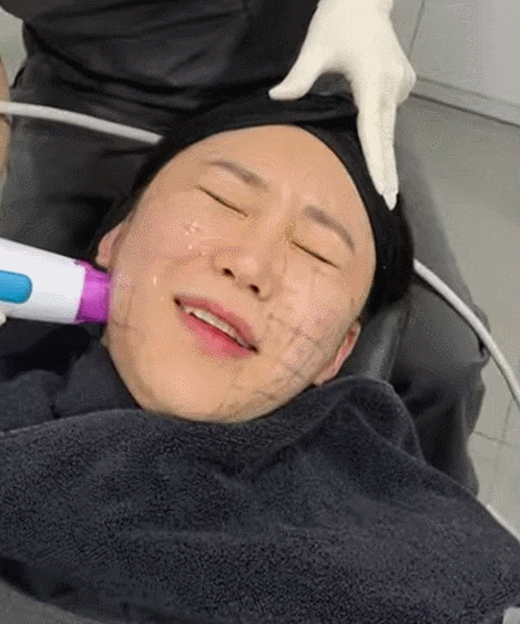 강남역 울쎄라 통증 정도, 수면마취 장점까지 피부과 원장의 솔직 조언 관련 이미지 15