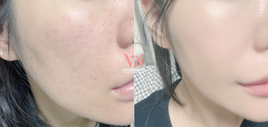 If You’ve Been Visiting a Dermatology Clinic Regularly but See No Change, the Issue May Be the Direction You’re Taking — Recommended Gangnam Dermatology Clinic Specializing in Rituo image 8