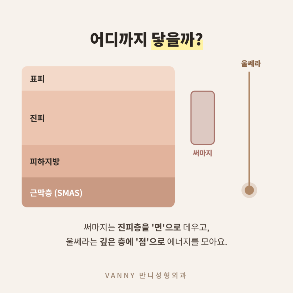 울쎄라 써마지 차이, 상담실에서 제일 많이 받는 질문 정리 관련 이미지 3