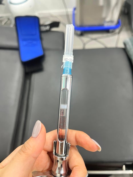 리쥬란힐러 통증 잡는 마취방법 5가지 피부과 원장의 총정리 관련 이미지 6