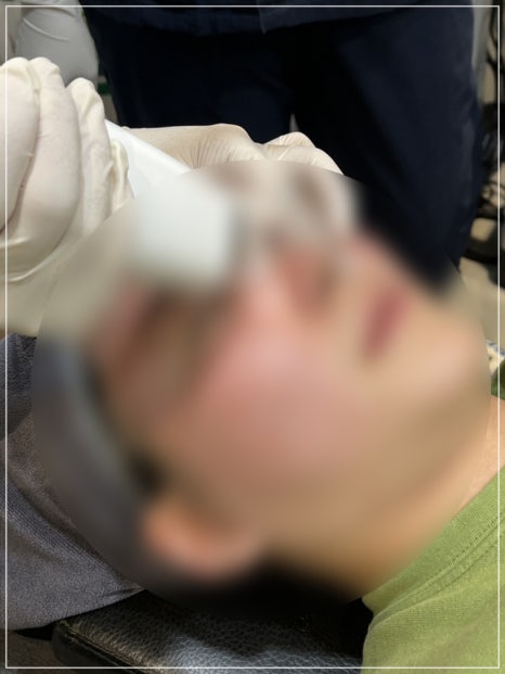 How to Reduce Pores in Gangnam: The Real Effect of Potenza Pumping Tip for Nose Pores, Explained by a Dermatology Clinic Director image 4