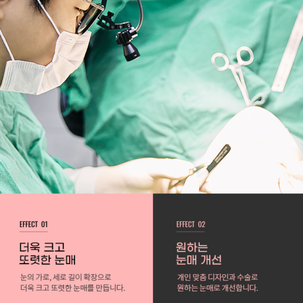 쌍커풀 윗트임 답답한 눈매를 시원하게 여는 방법 관련 이미지 5