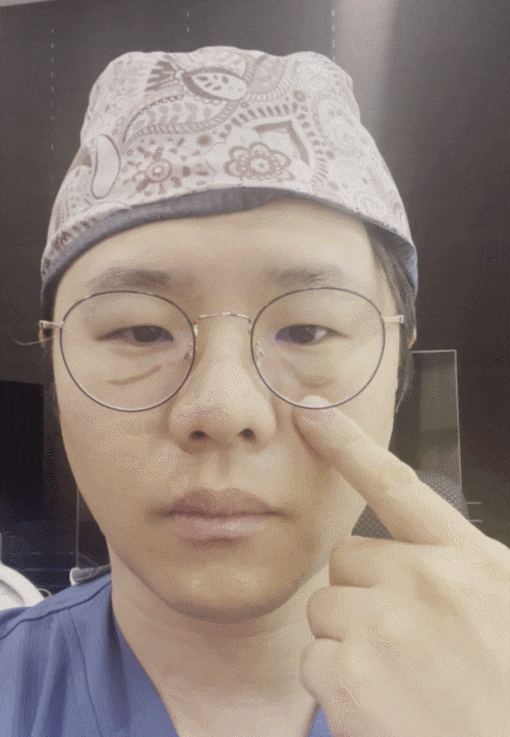 눈밑지방재배치 다크서클 해결 가능? 성형외과 전문의의 솔직 의견 관련 이미지 10