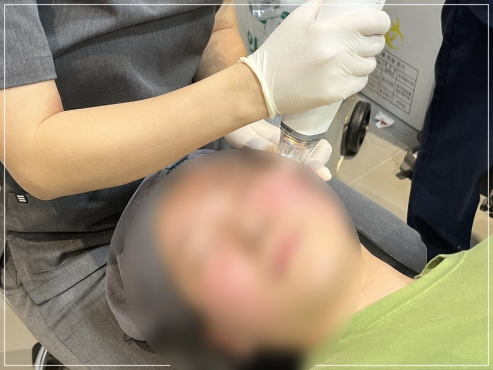 How to Reduce Pores in Gangnam: The Real Effect of Potenza Pumping Tip for Nose Pores, Explained by a Dermatology Clinic Director image 22
