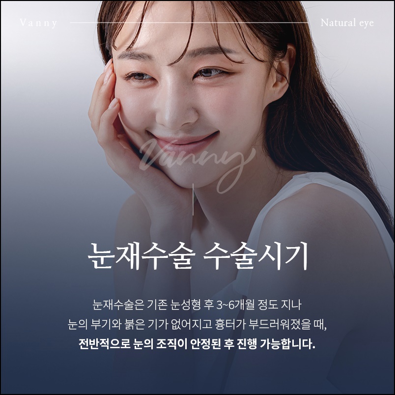 강남눈성형외과 두번의 실패를 하지 않기 위해 관련 이미지 6