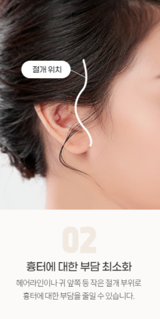Forehead Lift Before and After: If You Want a Safer and More Effective Method image 5