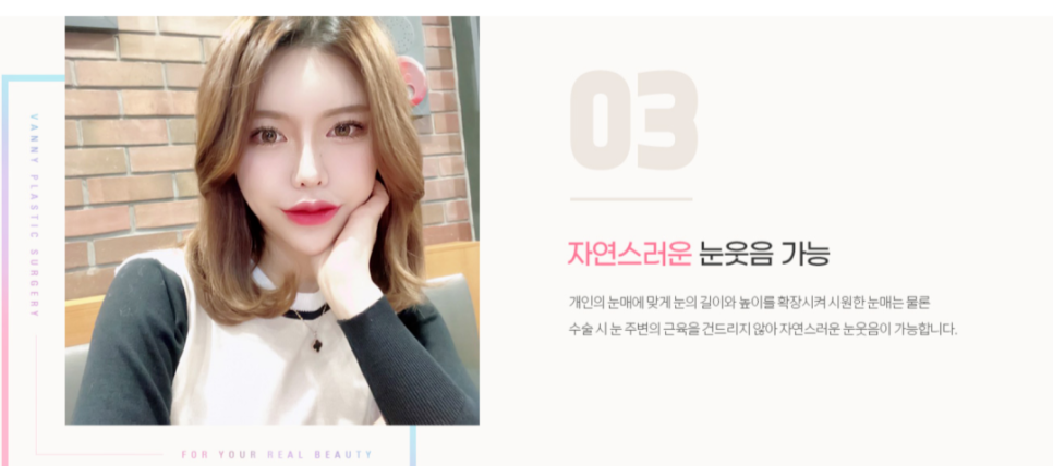 연예인 뒷트임 자연스럽게 눈매를 확장하는 방법 관련 이미지 6