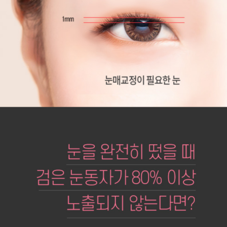 Key Points That Reveal the Difference Before and After Male Eye Correction image 3