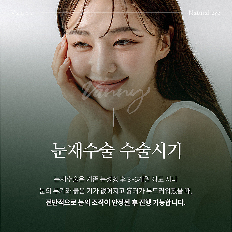 강남눈성형잘하는곳 다시 알아보게 된다면 관련 이미지 6