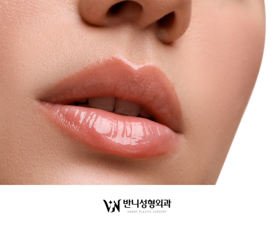 Natural Lip Filler: Achieving Volume and Harmony at the Same Time image 6