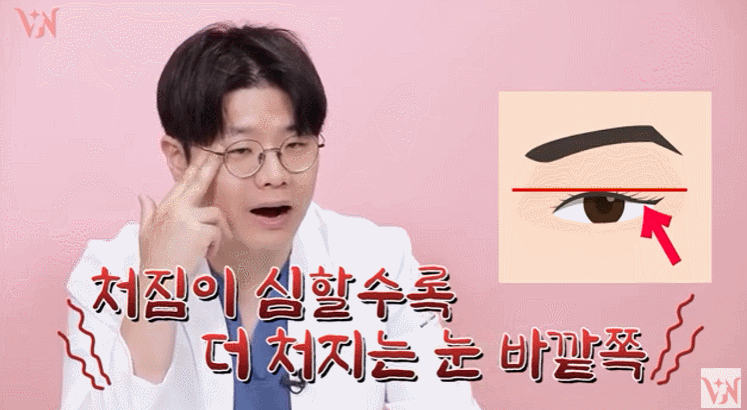 강남눈성형외과 잘하는 곳 구분하는 방법 3가지, 전문의가 알려드림 관련 이미지 3
