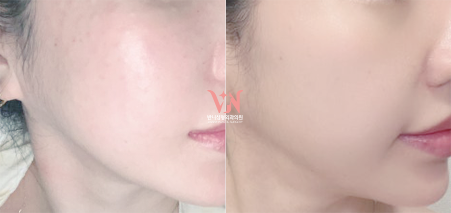 If You’ve Been Visiting a Dermatology Clinic Regularly but See No Change, the Issue May Be the Direction You’re Taking — Recommended Gangnam Dermatology Clinic Specializing in Rituo image 5