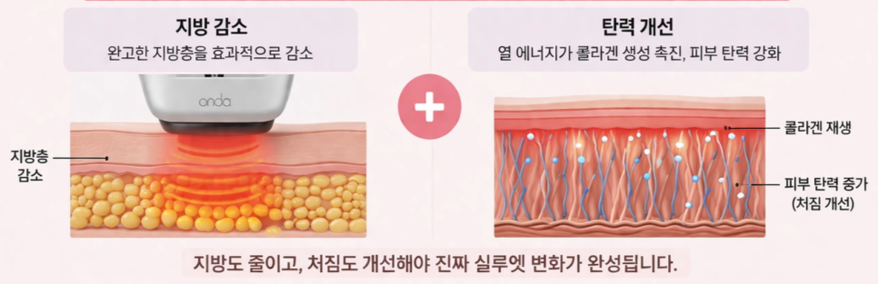강남 온다 리프팅 망하는 가장 흔한 이유, 온다 리프팅 문의 하루 30건 받는 강남 피부과 원장이 솔직하게 말씀드립니다. 관련 이미지 22