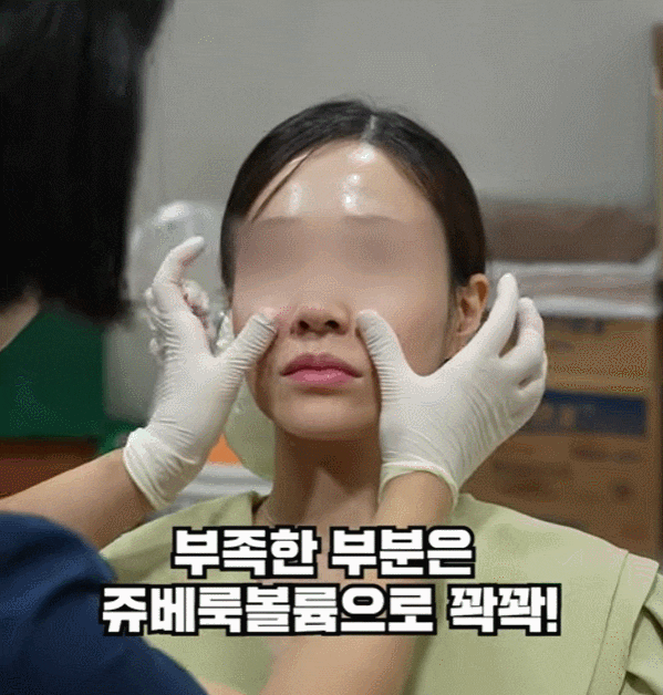 The Best Place for Thread Lifting for Nasolabial Folds in Gangnam Improves Both Hollowness and Sagging. image 16