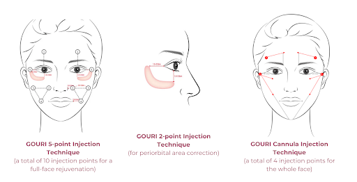 What the Reviews of Gouree Skin Booster Bought with My Own Money Say in Common image 21