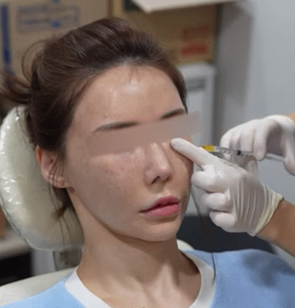 A Doctor with 20,000 Clinical Cases Shares How to Find the Best Under-Eye Filler Clinic in Gangnam image 13
