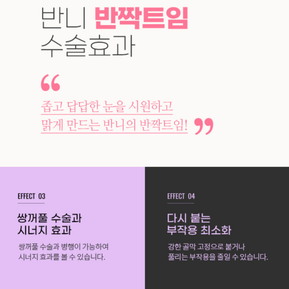 쌍커풀 윗트임 답답한 눈매를 시원하게 여는 방법 관련 이미지 6