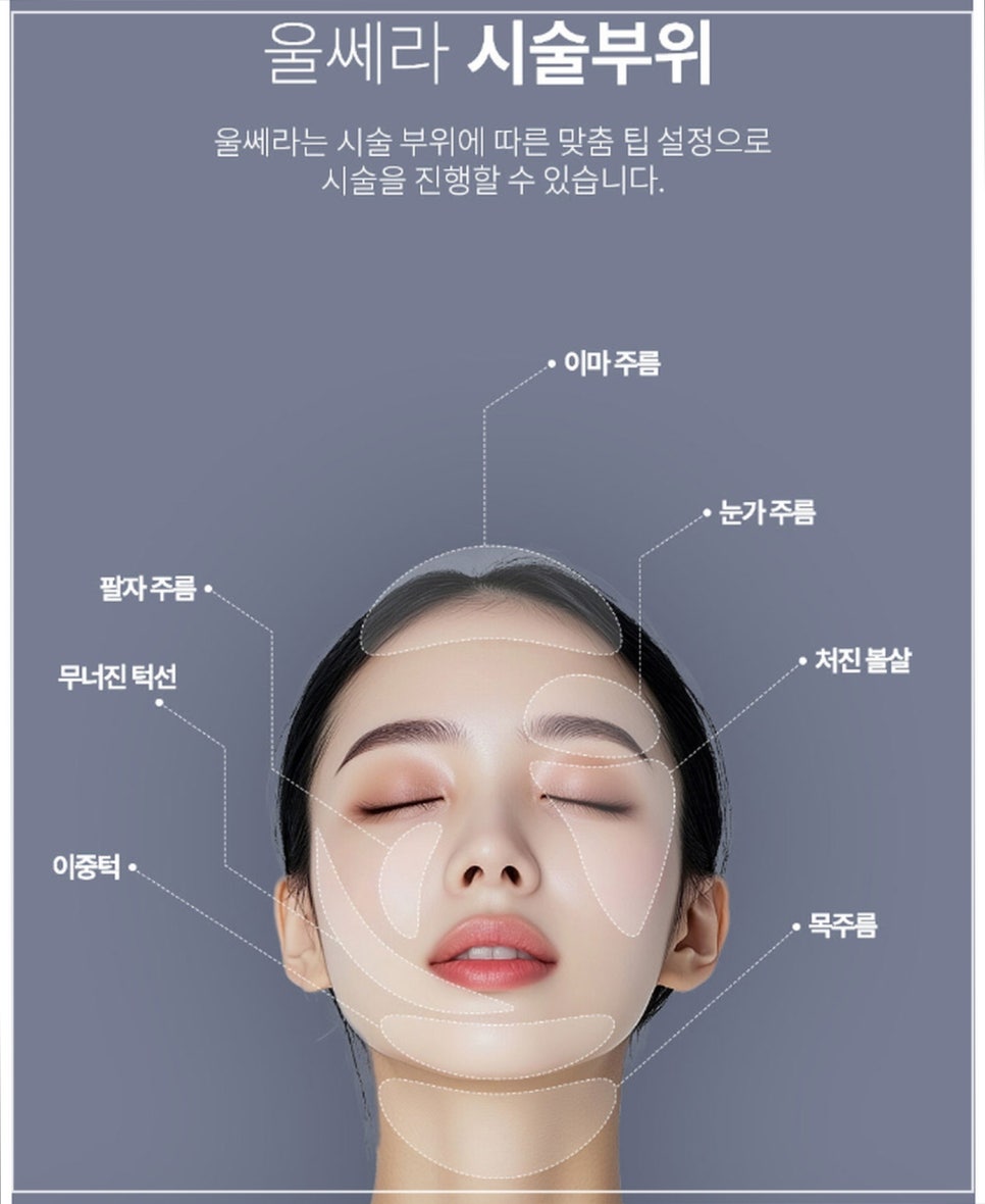 강남역 울쎄라 통증 정도, 수면마취 장점까지 피부과 원장의 솔직 조언 관련 이미지 6