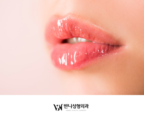 Natural Lip Filler: Achieving Volume and Harmony at the Same Time image 2