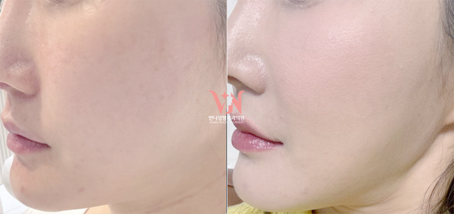 If You’ve Been Visiting a Dermatology Clinic Regularly but See No Change, the Issue May Be the Direction You’re Taking — Recommended Gangnam Dermatology Clinic Specializing in Rituo image 3
