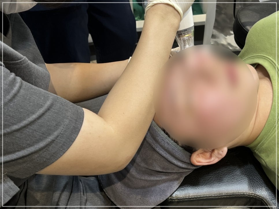 포텐자 여드름, 흉터 자국까지 하나로 올킬 가능한 이유 (+펌핑팁 효과) 관련 이미지 17
