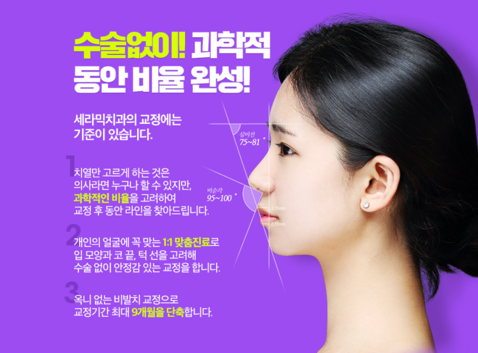 세라믹치아교정만 19년째 관련 이미지 4