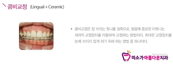 학동역치아교정치과 미소가아름다운치과의 교정창지 관련 이미지 5