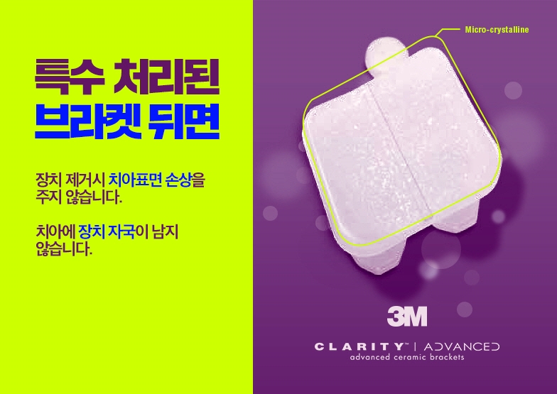 세라믹치과 돌출입교정은 미국3M 치아교정으로 관련 이미지 9