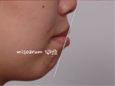 강남치아교정추천 관련 이미지 41