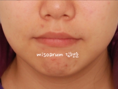 강남치아교정추천 관련 이미지 35